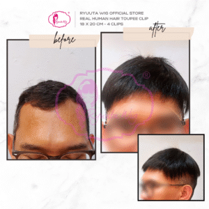 Toupee Topper Clip Man Short Human Hair 18 x 20 cm