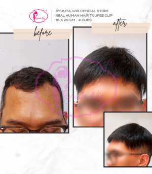 Toupee Topper Clip Man Short Real Human Hair 18 x 20 cm